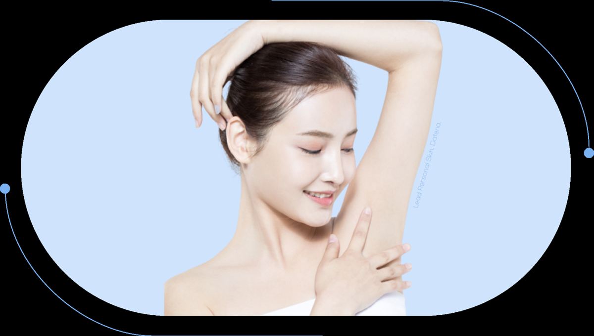 脫毛激光 4
